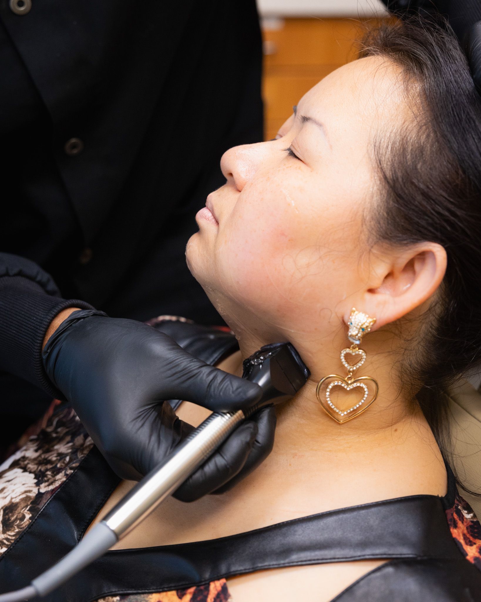 A woman with heart shaped earrings is getting a treatment on her neck.