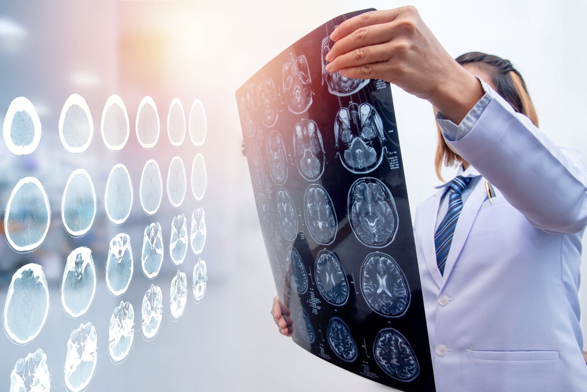 Brain Injury Claims