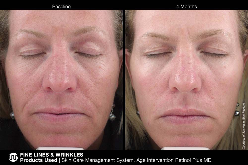 before and after skin care management