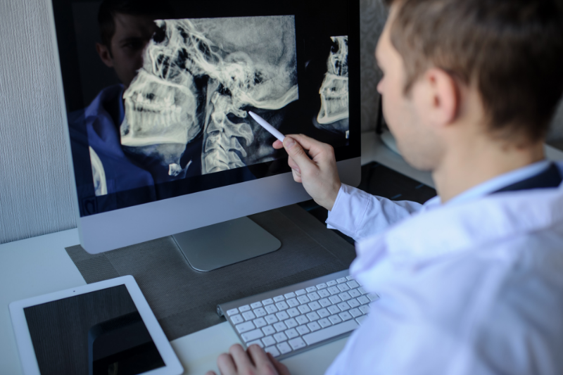 doctor reviewing neck x-rays