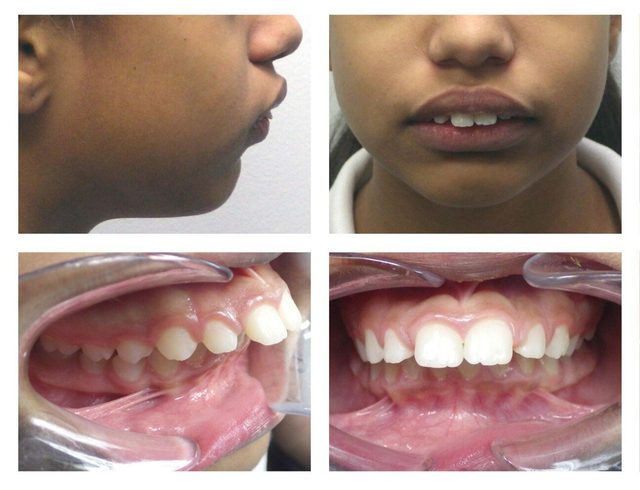 Orthodontist, Lawrence, MA