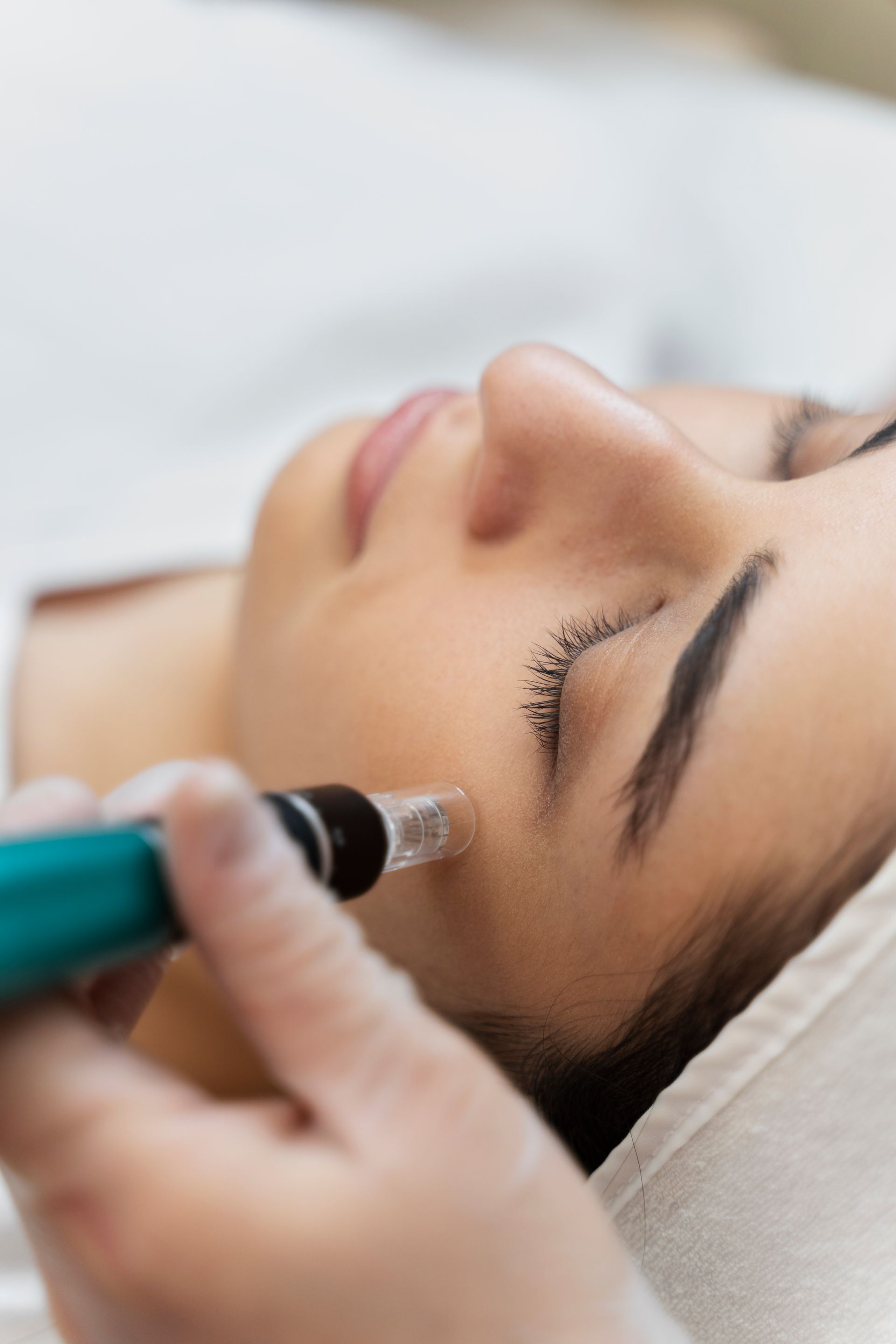 A woman is getting a treatment on her face with a pen.