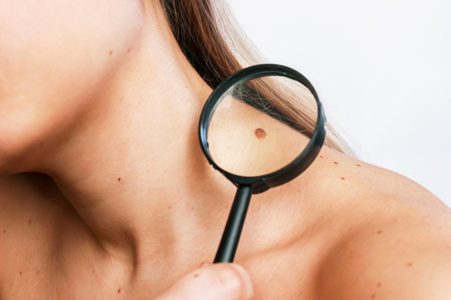 Woman examines mole on shoulder with magnifying glass.