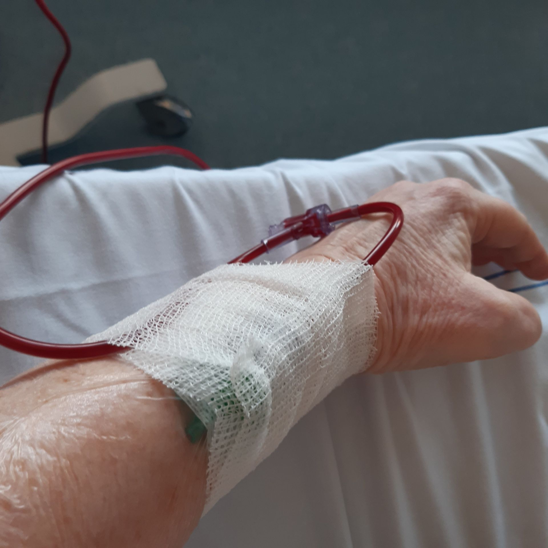 Bloedtransfusie - chemo uitgesteld