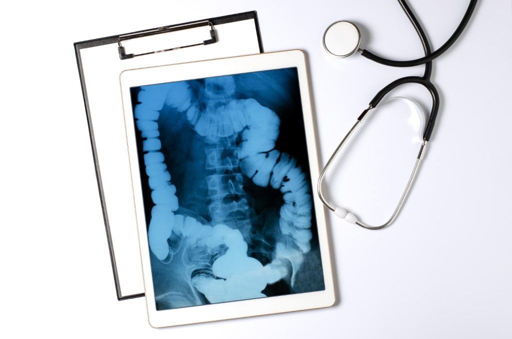 X-ray of colon on tablet with clipboard and stethoscope.