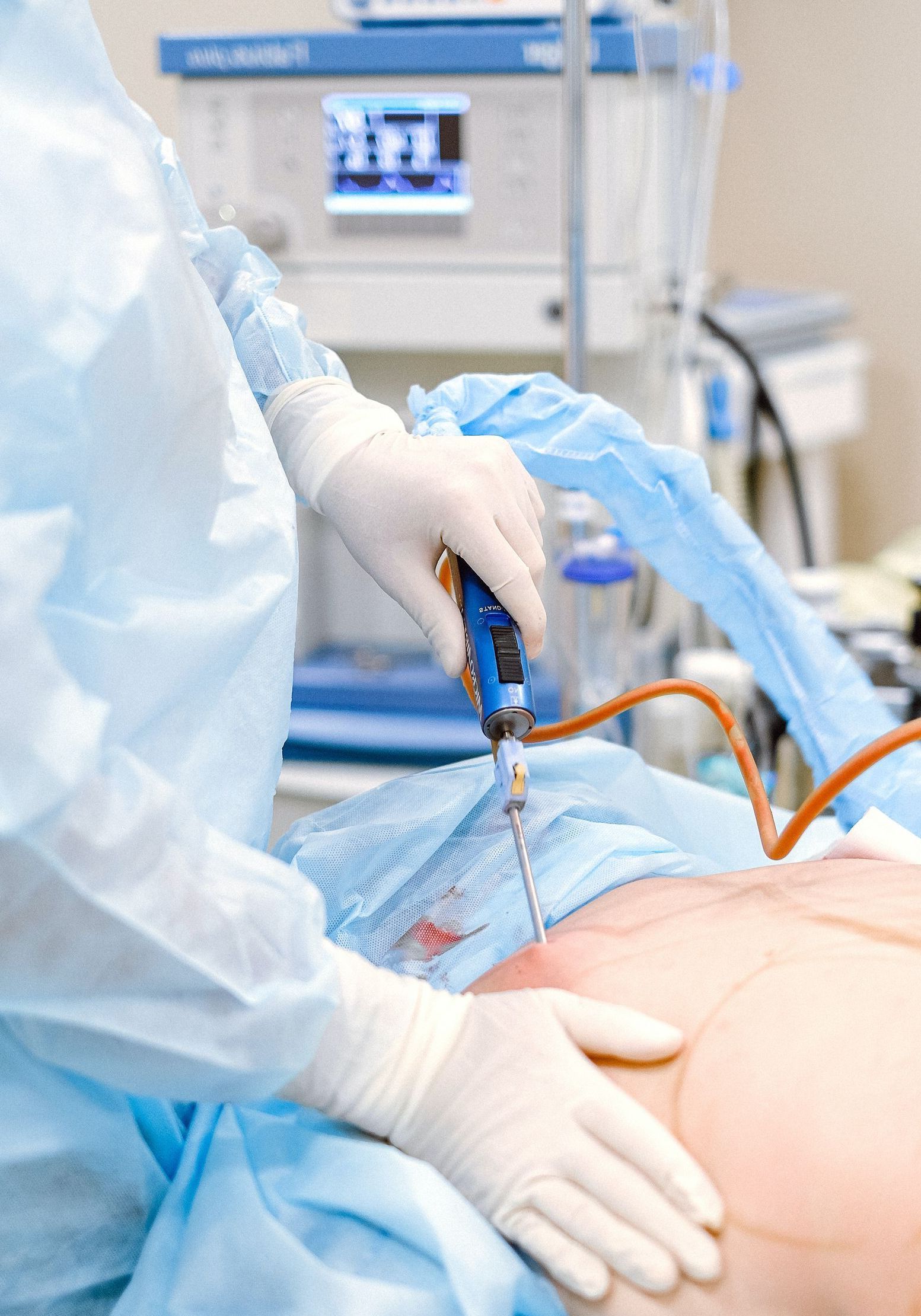 A surgeon is doing liposuction on a patient in an operating room.