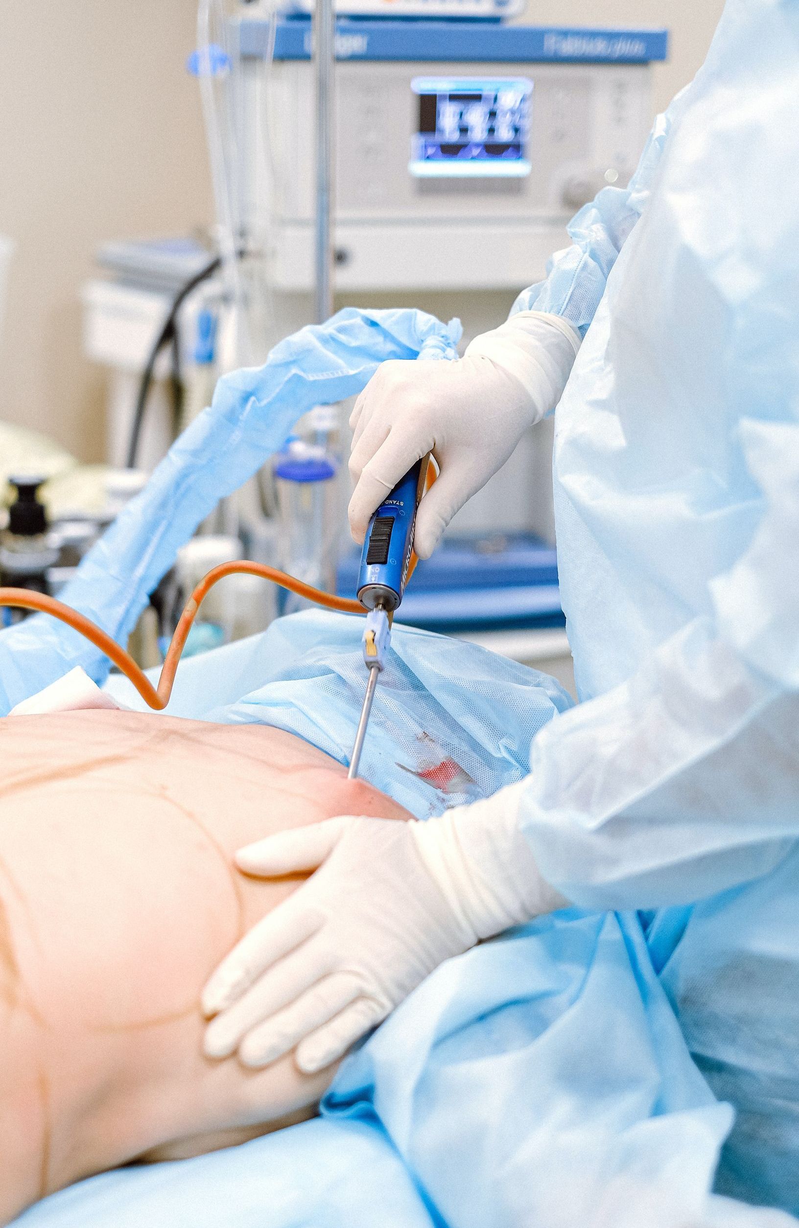 A surgeon is performing liposuction on a patient in an operating room.