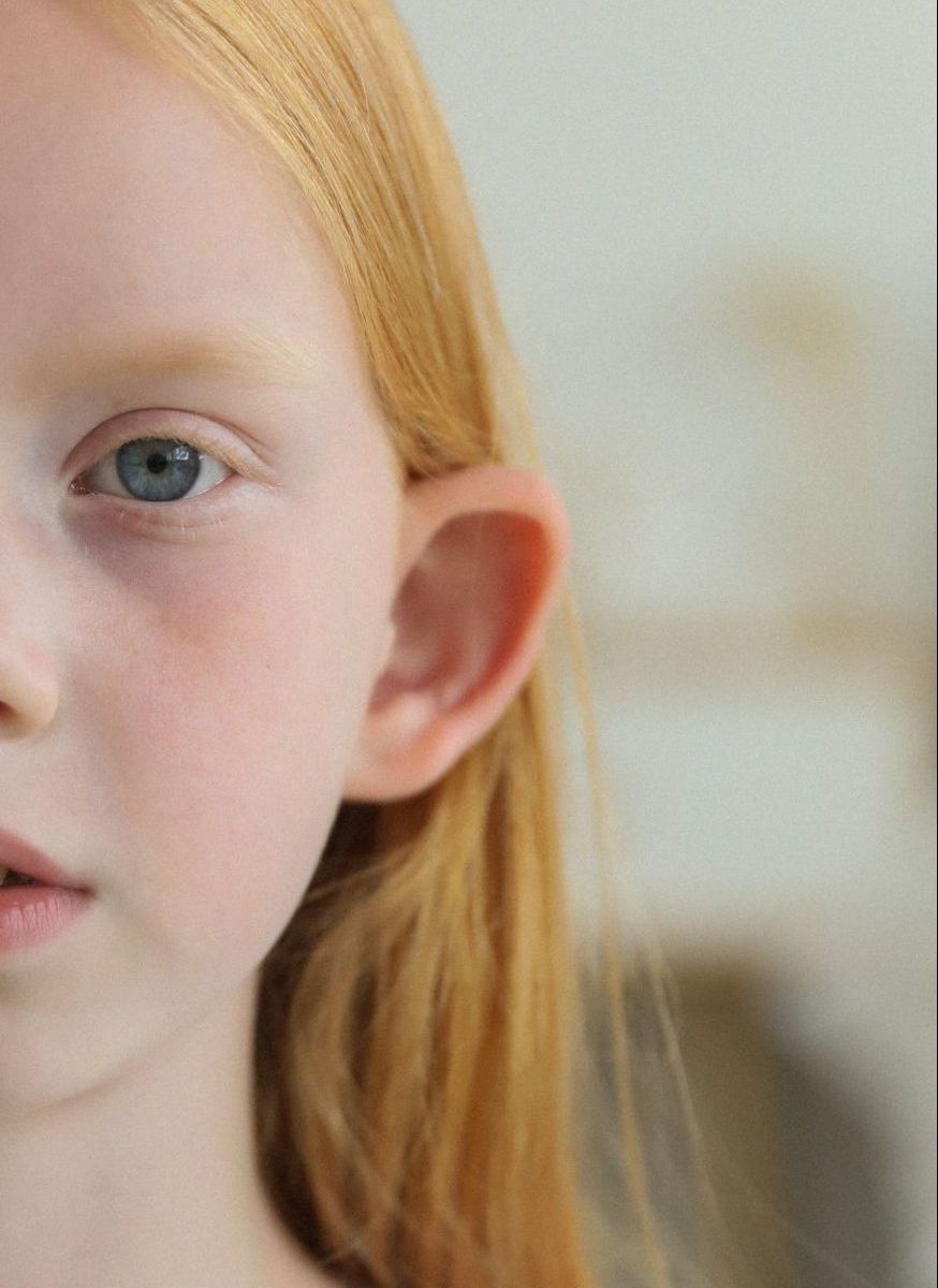 A close up of a young girl 's face with red hair and blue eyes and protruding ears.