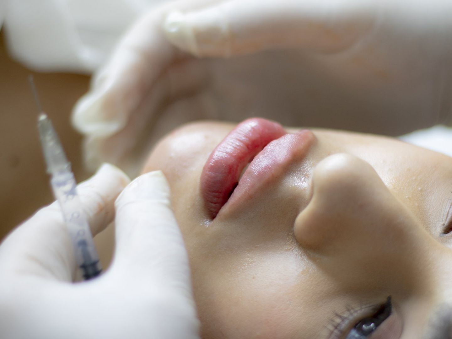 The Ultimate Guide to Choosing Between Botox and Fillers