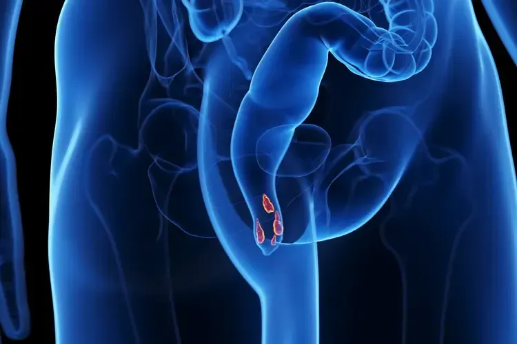 Rectal bleeding can be a concerning symptom often associated with conditions like hemorrhoids.