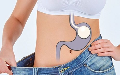 Gastric balloons have emerged as a non-surgical option for individuals seeking effective weight loss