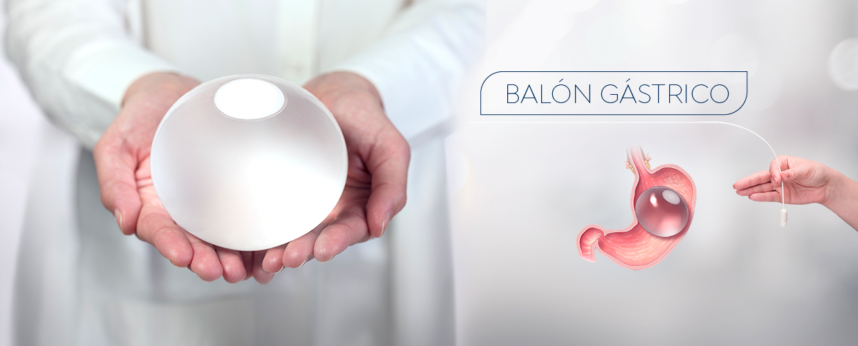 The Orbera® Gastric Balloon is a widely used, non-surgical weight loss option
