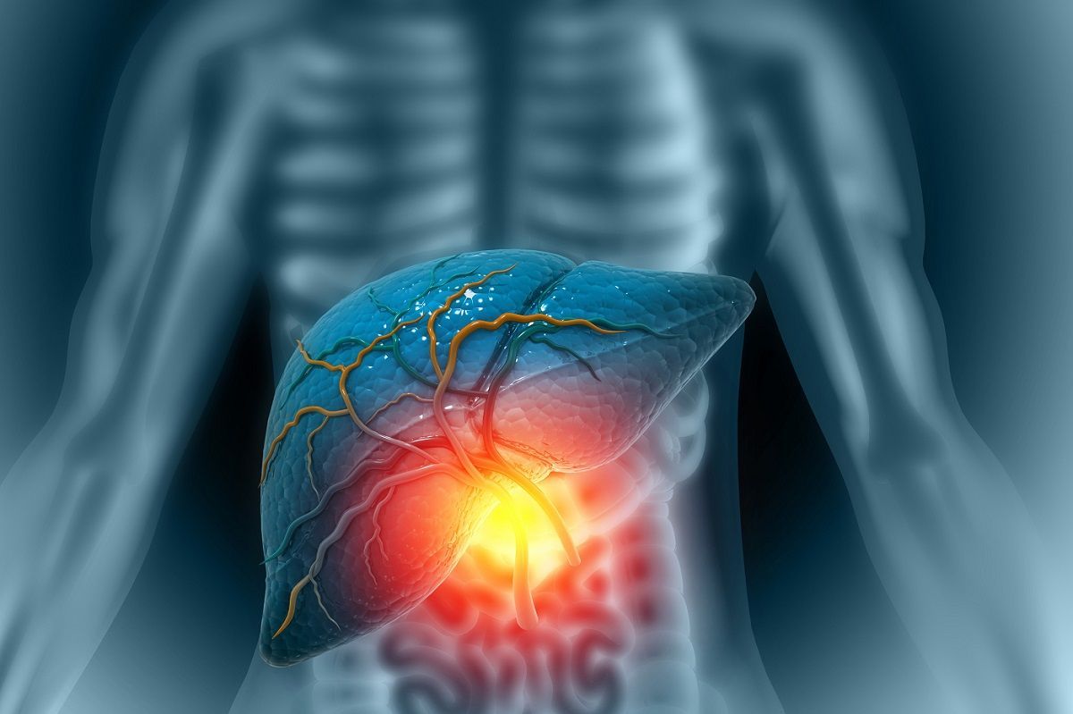 Fatty liver disease is a prevalent condition characterized by the accumulation of fat in the liver