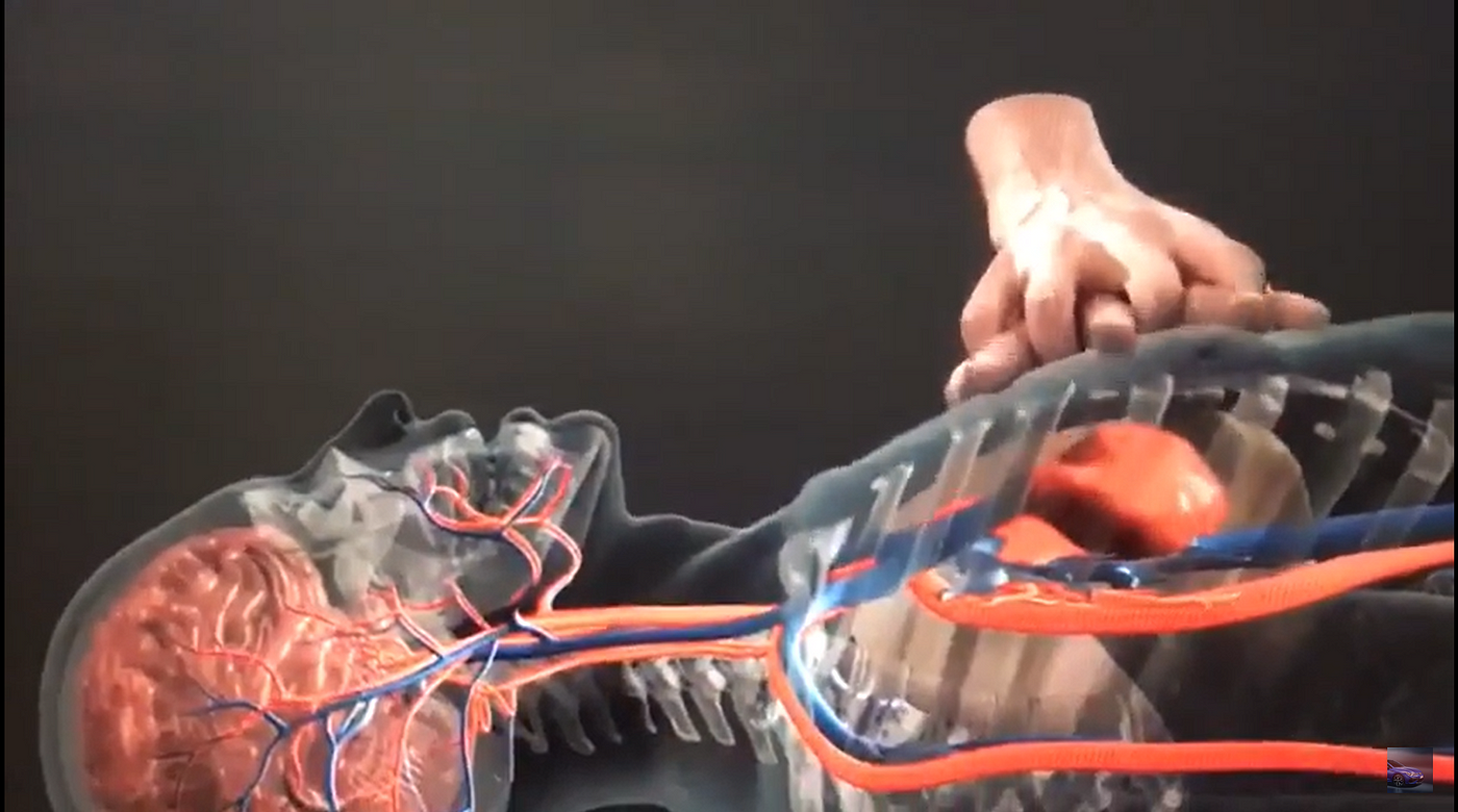 A person is holding a model of a person 's heart and veins.
