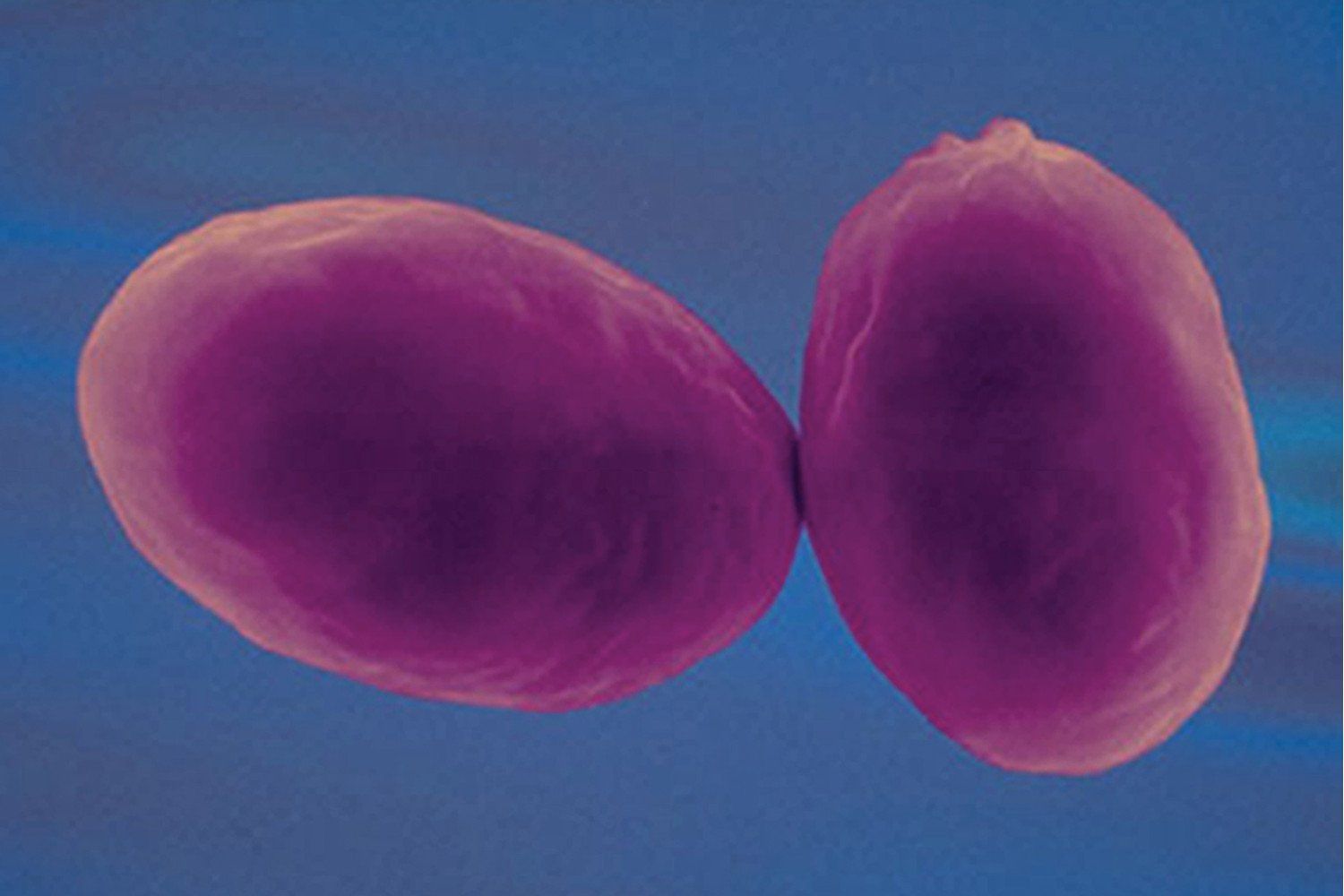 Giardia — Orlando, FL — Florida Pure Water Solutions