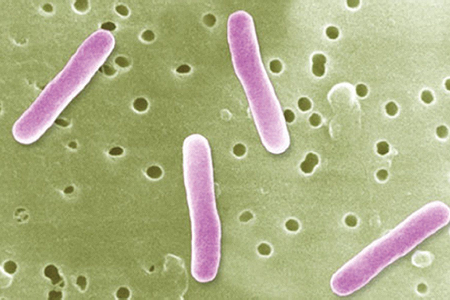 Salmonella — Orlando, FL — Florida Pure Water Solutions