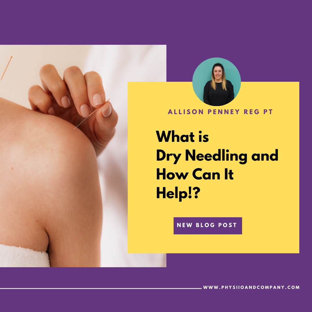 Learn about dry needling and how it can improve symptoms and get you back to pain free faster