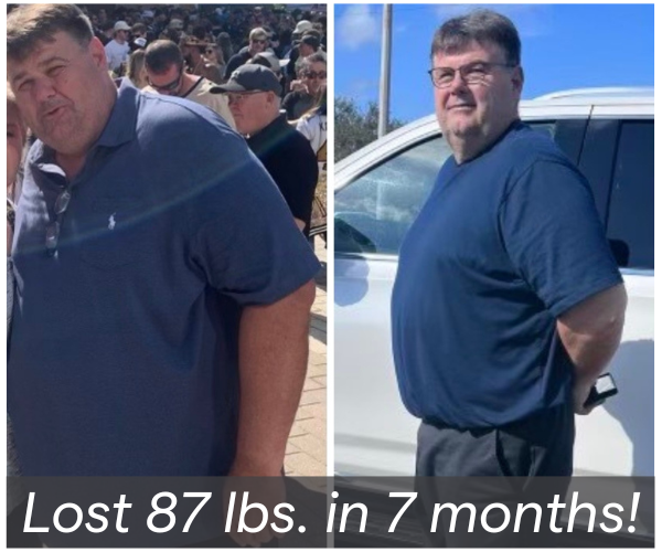 Louisiana Physician-supervised weight loss program results | Fat loss shots transformation | CHRONOS