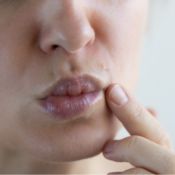 Remove unwanted hair with med spa treatments in Metairie | Chronos BHW