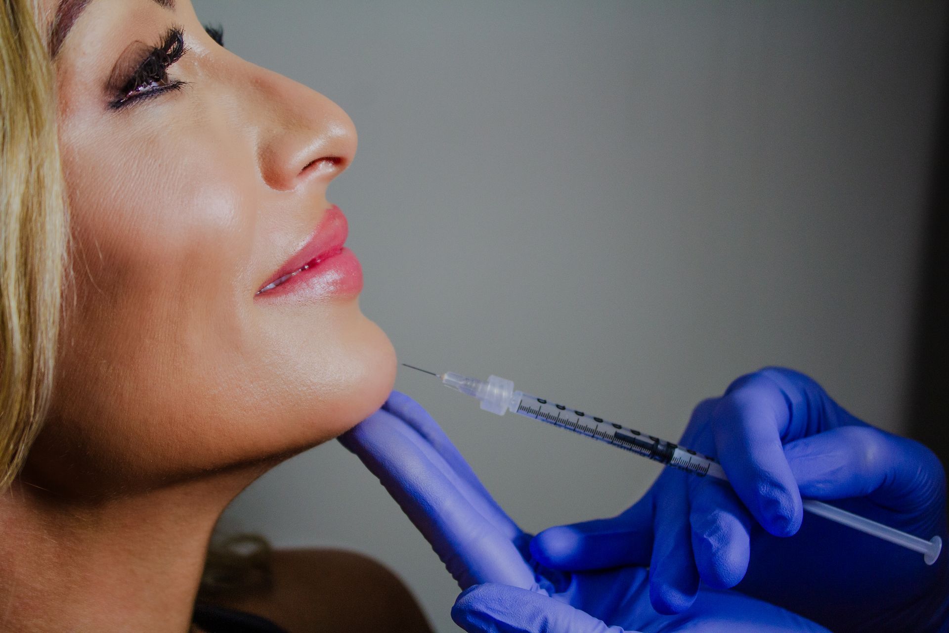 Provider injecting Radiesse in chin | dermal filler injections near me in Metairie, LA