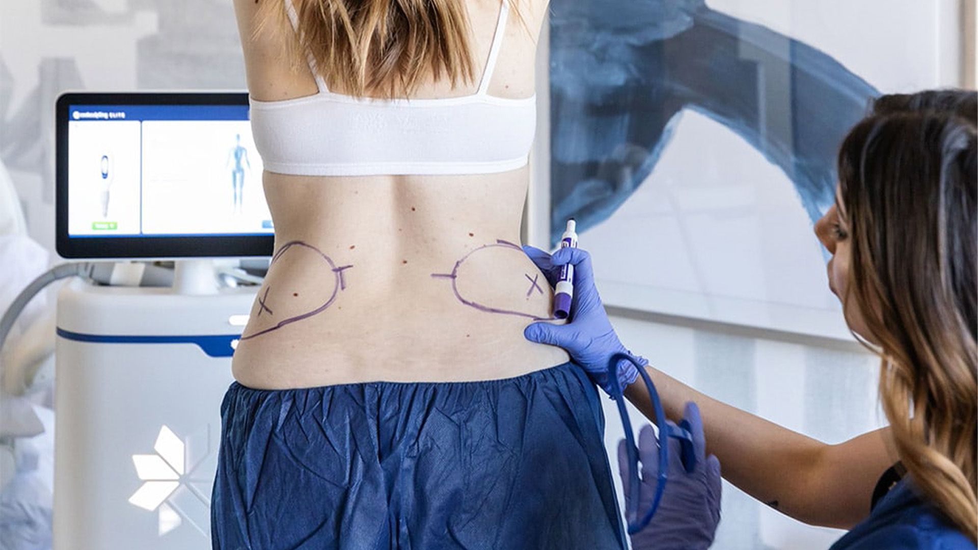 CoolSculpting Consultation Event in Metairie | Chronos BHW
