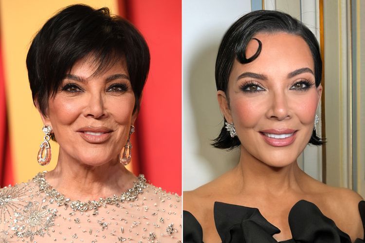 Kris Jenner's recent face transformation causing buzz on social media Anti-aging treatments