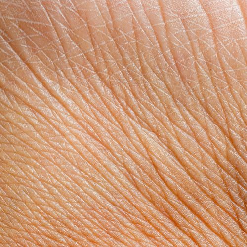 Treat fine lines and wrinkles with med spa services at Chronos BHW in Metairie