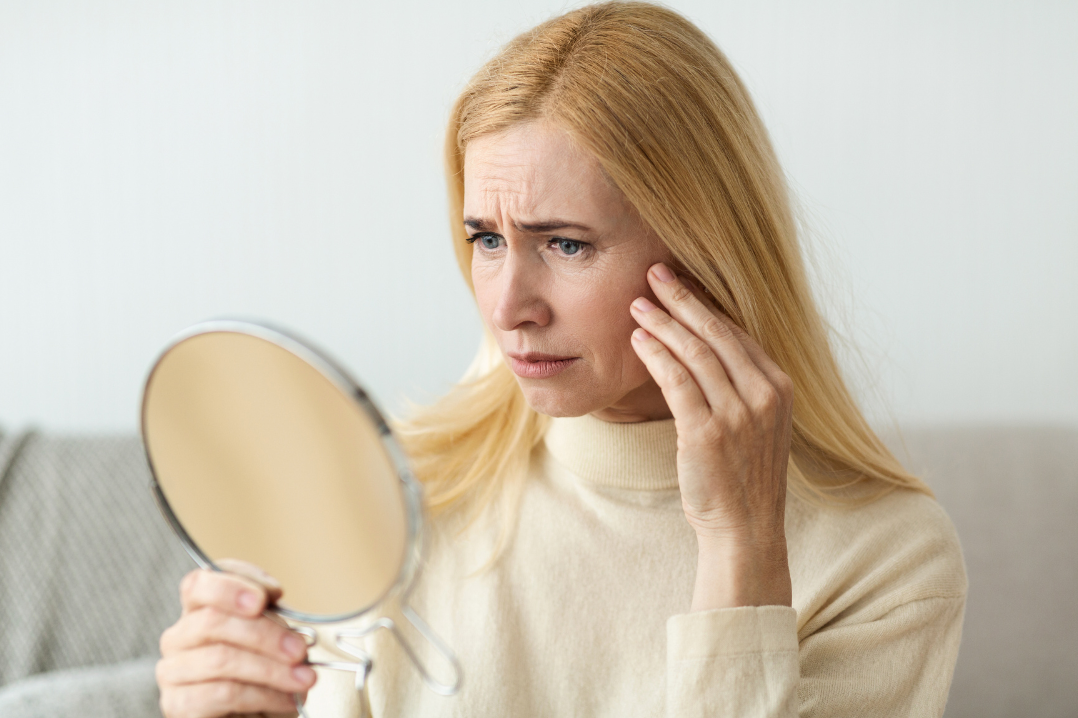 Woman showing facial changes after rapid weight loss from GLP-1 treatment