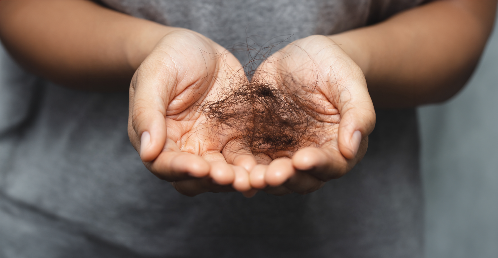 Hair loss treatments in Metairie, LA | Hair Restoration at Chronos Body Healthy & Wellness