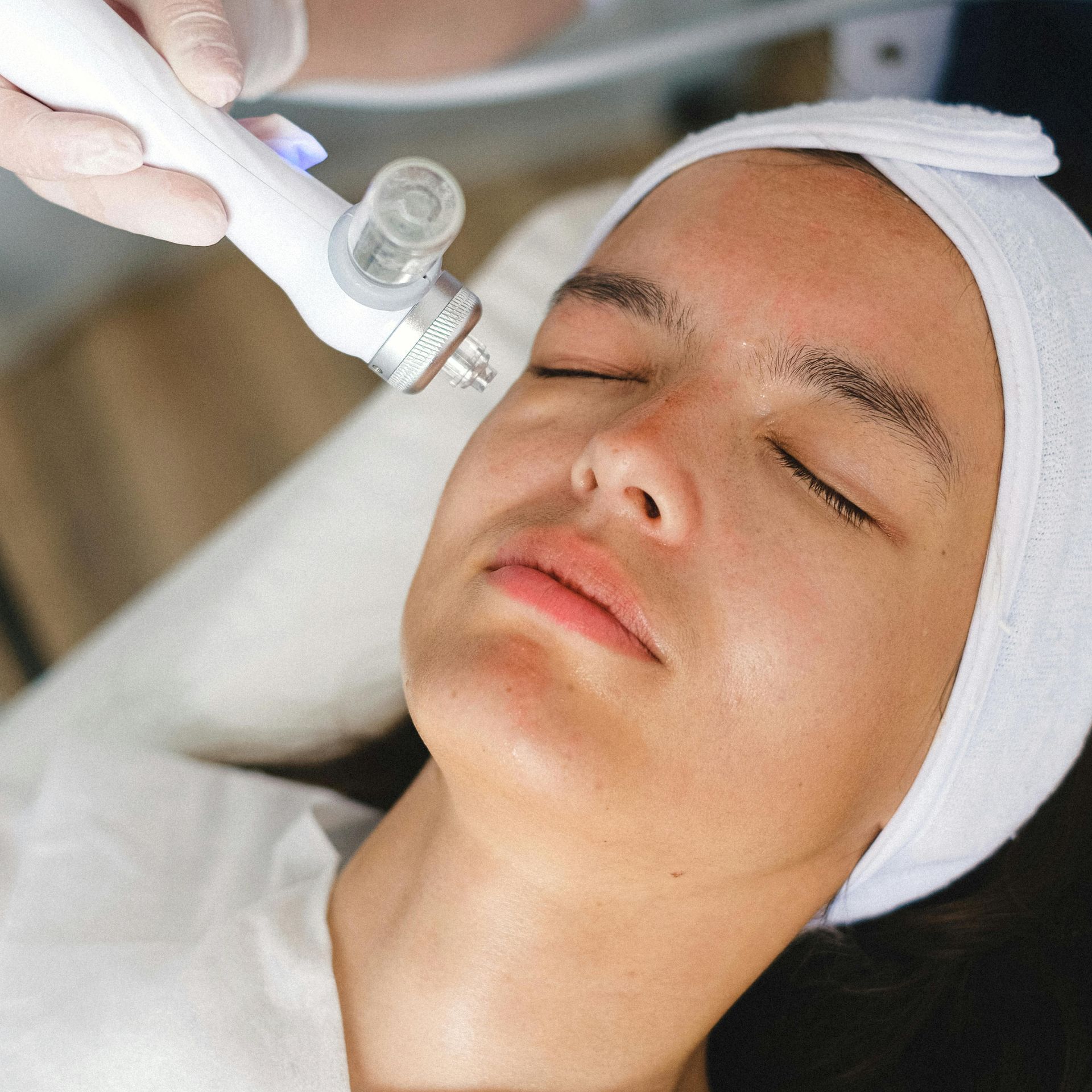 Chrome Refresh treatment for treating dark spots and brown spots | Treat hyperpigmentation at Chronos BHW