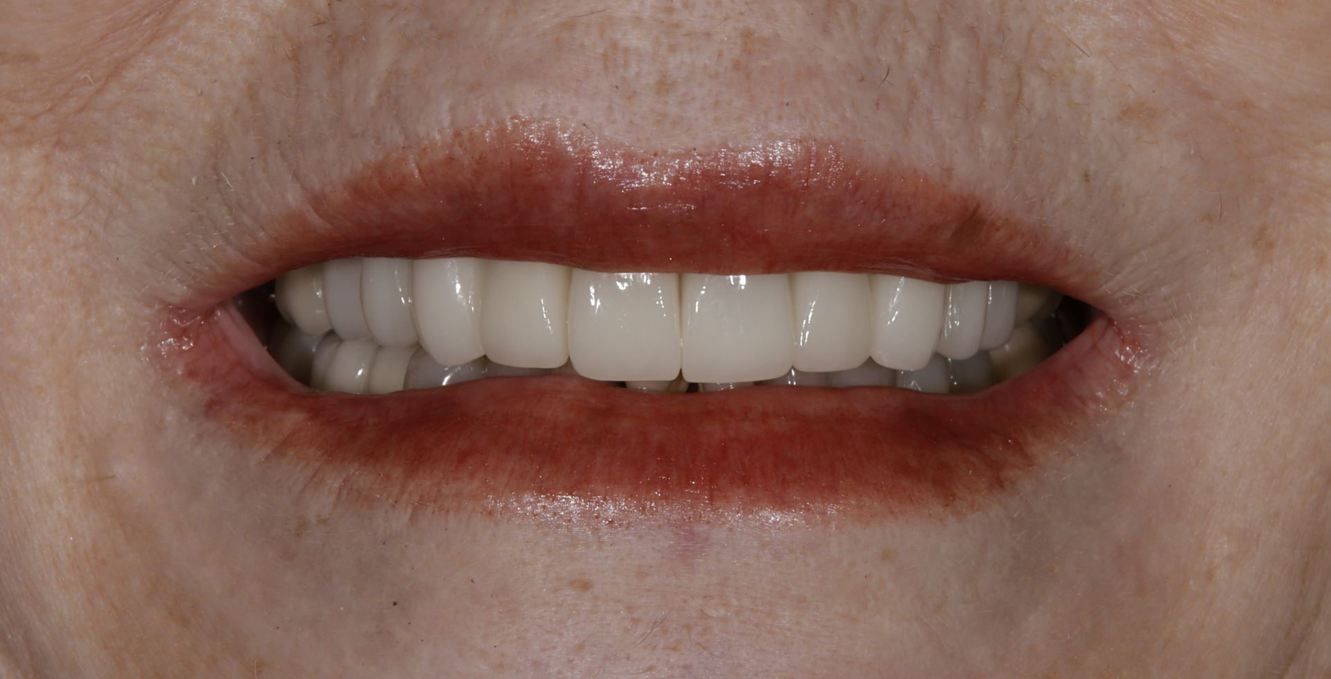 A close up of a woman 's mouth with white teeth and red lips.