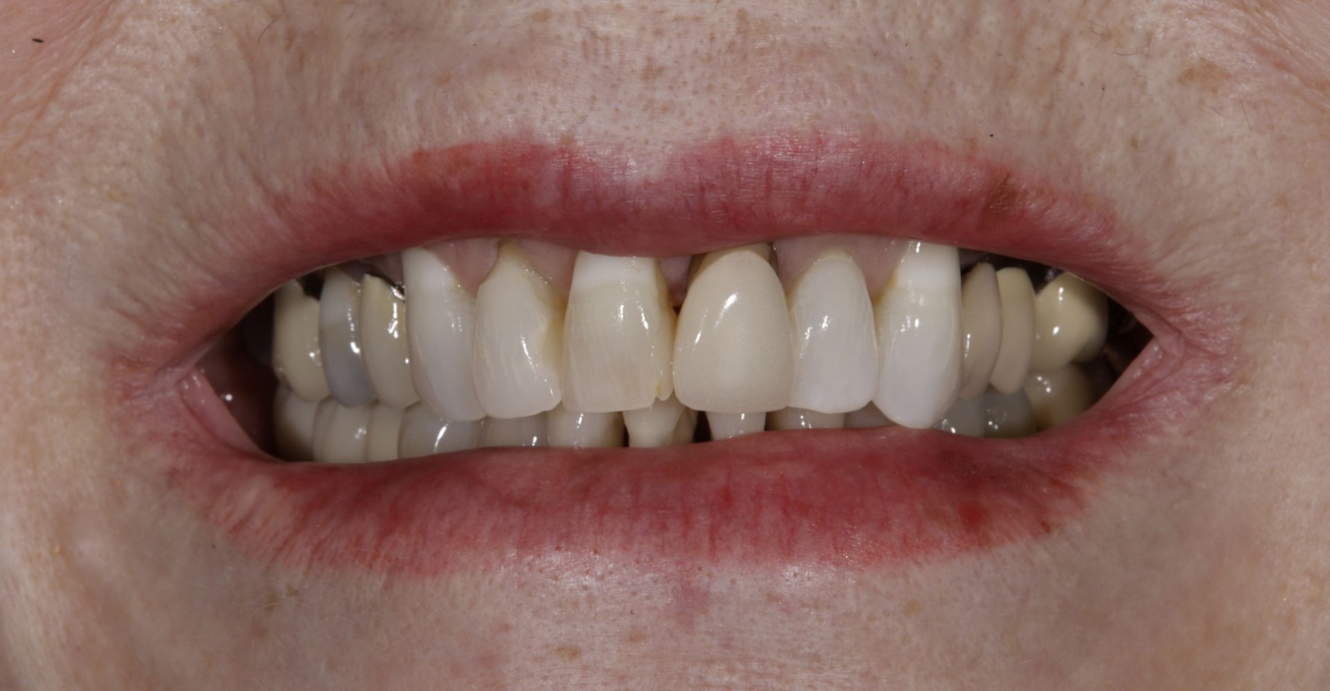 A close up of a person 's mouth with white teeth and red lips.