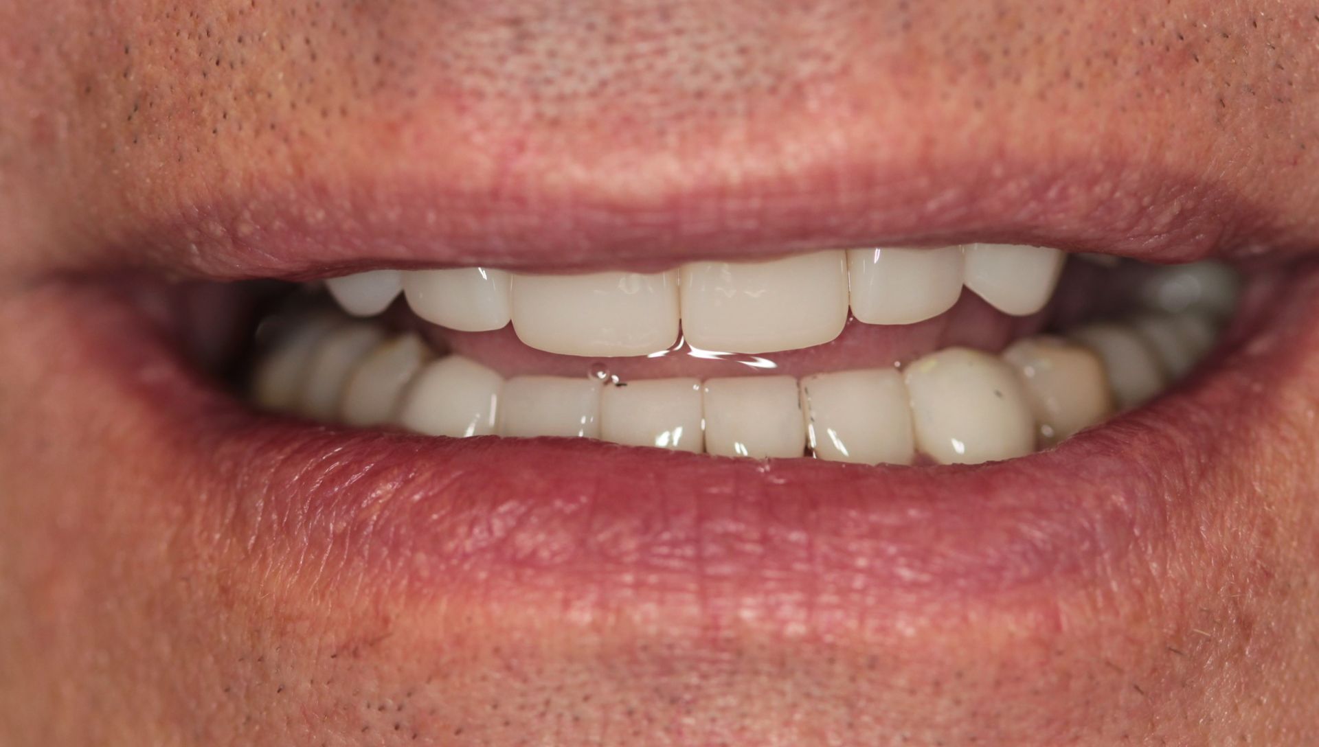 A close up of a man 's mouth with white teeth.