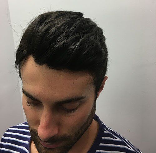 Hair replacement & fitting consultancy