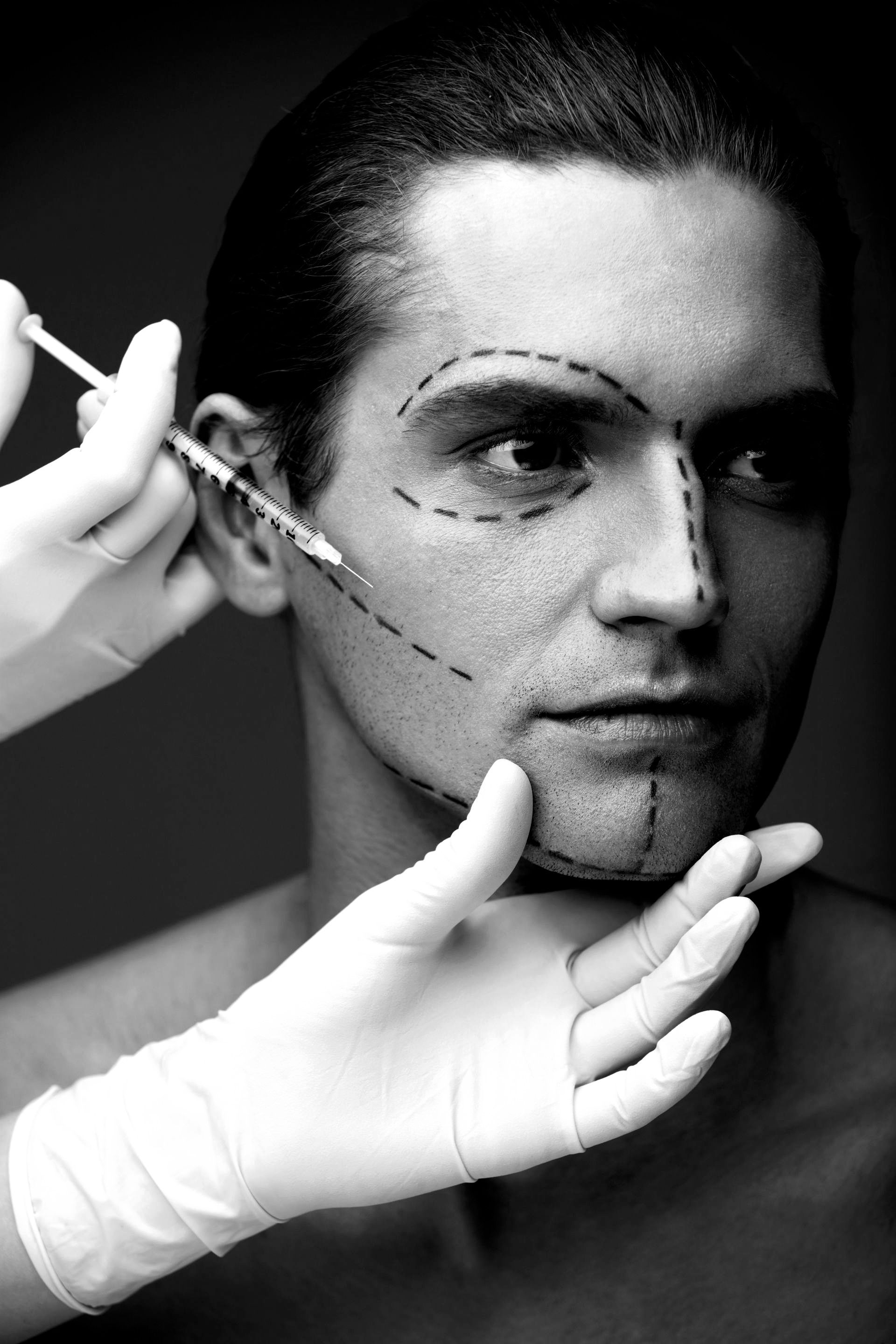 Sculptra Treatment in Plano TX