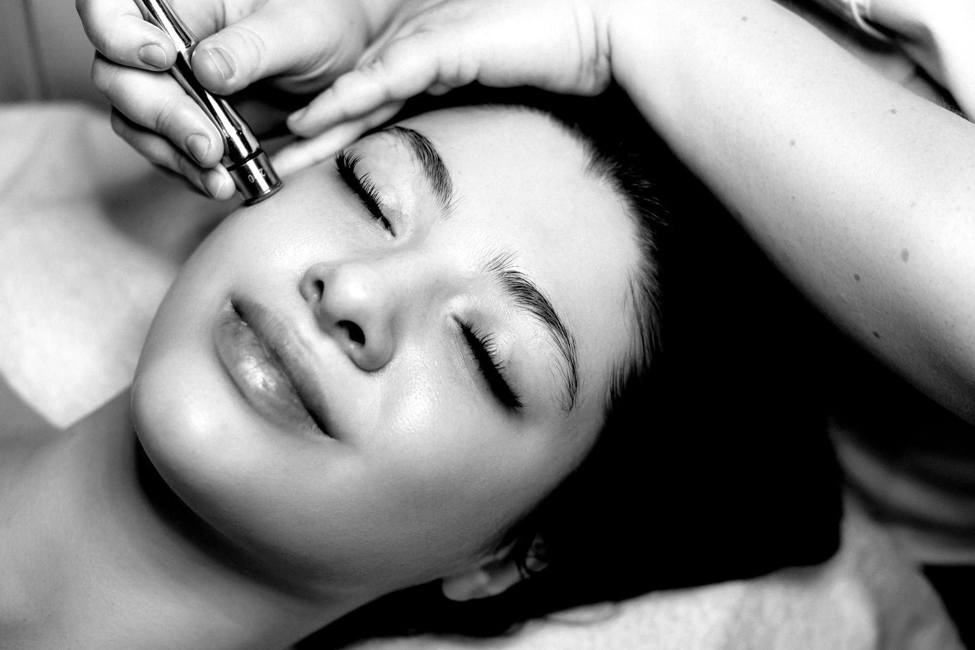 Microneedling treatment in Plano, Texas