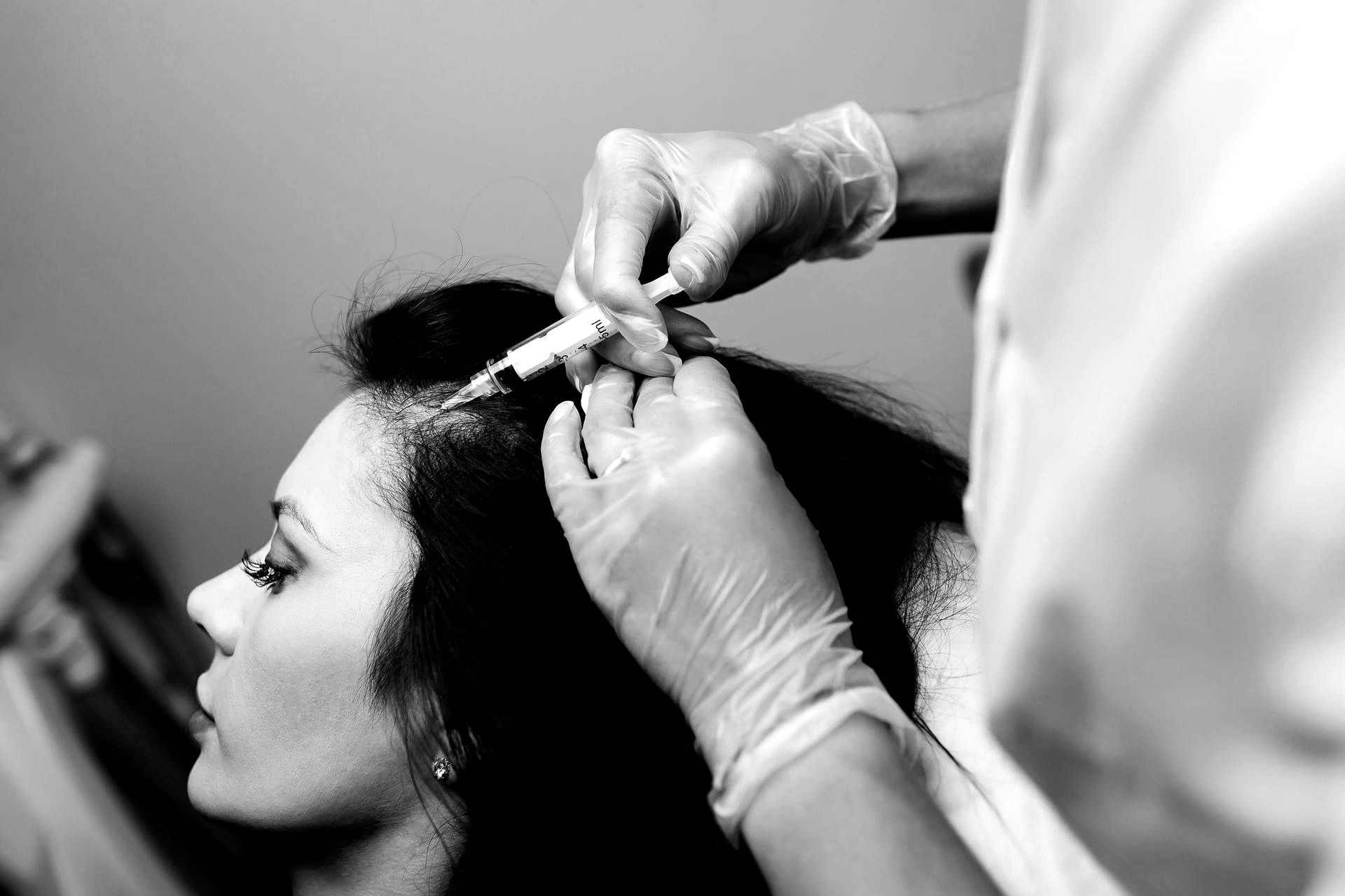 PRP Injections for hair restoration in Plano, TX