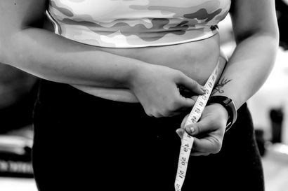 Medical Weight loss results in Plano