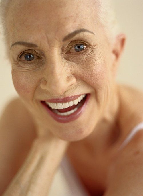 Older Lady With New Dentures