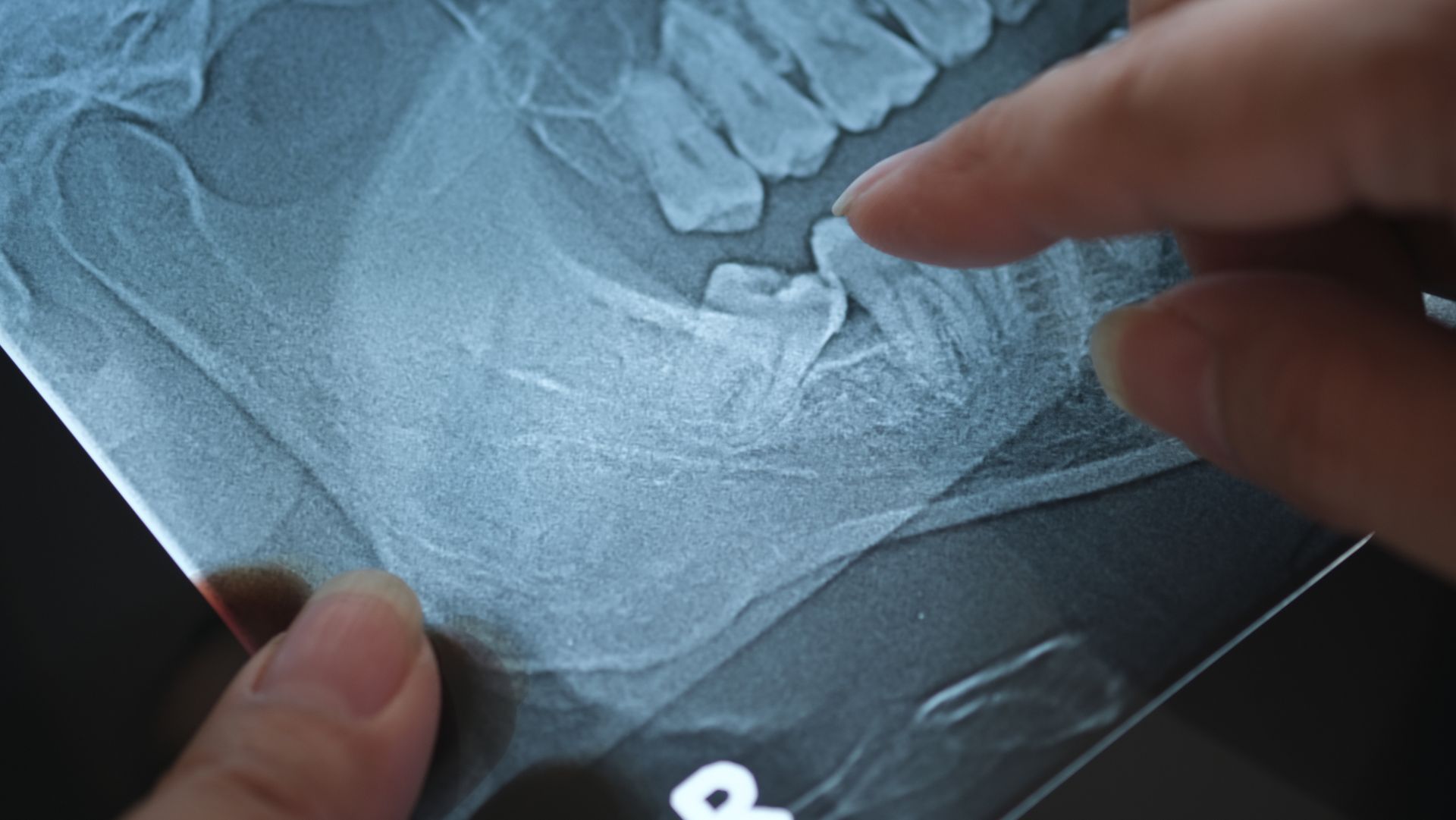 A person is pointing at an x-ray of a child 's teeth.