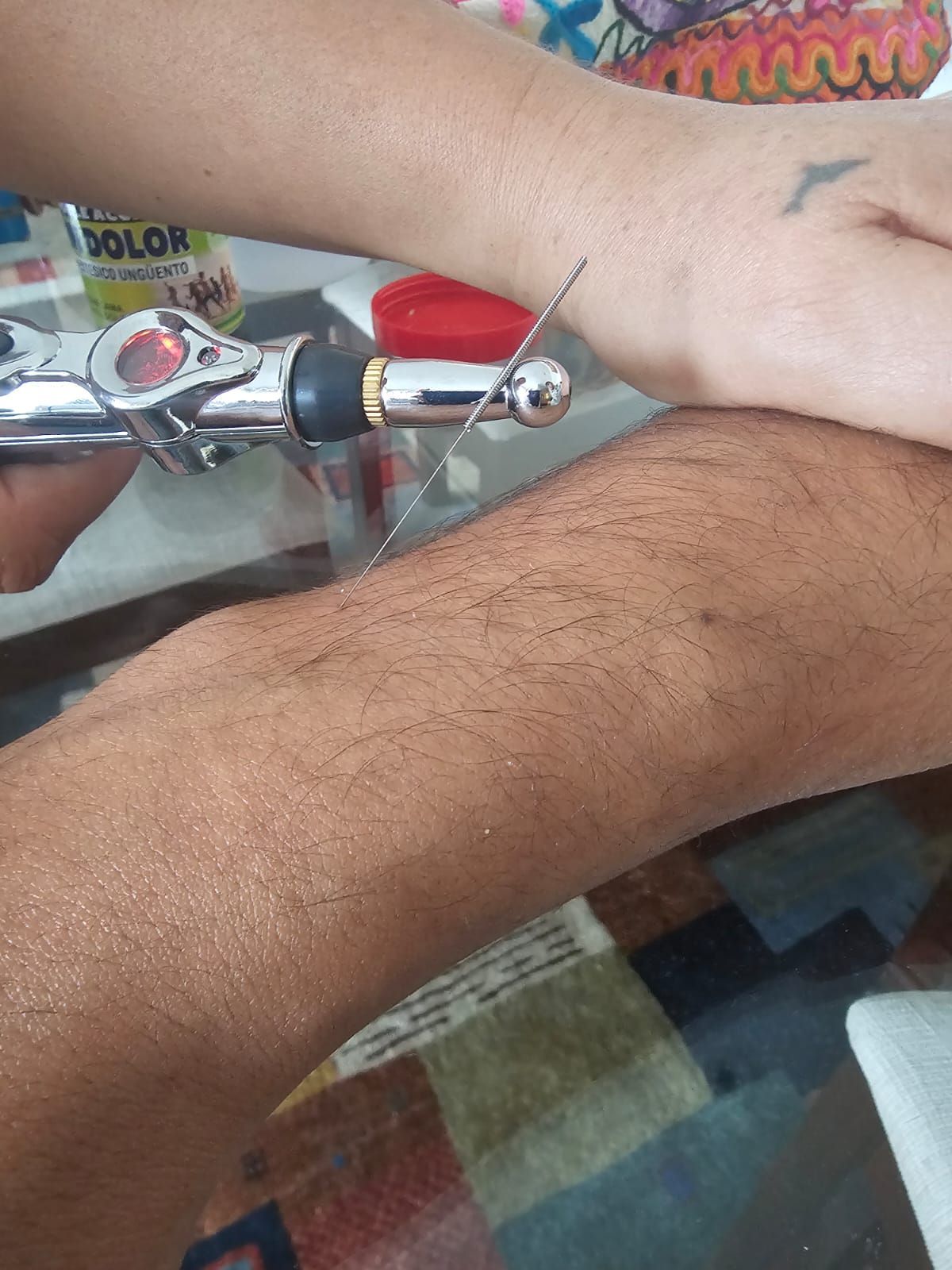 Pie con un catéter intravenoso insertado cerca del tobillo, apoyado sobre una sábana blanca.