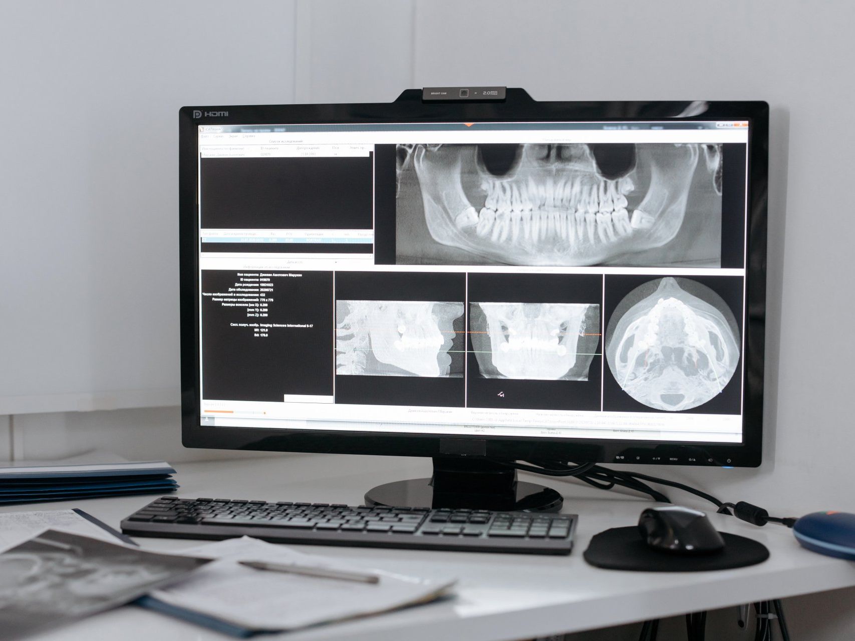 Periodontal therapy