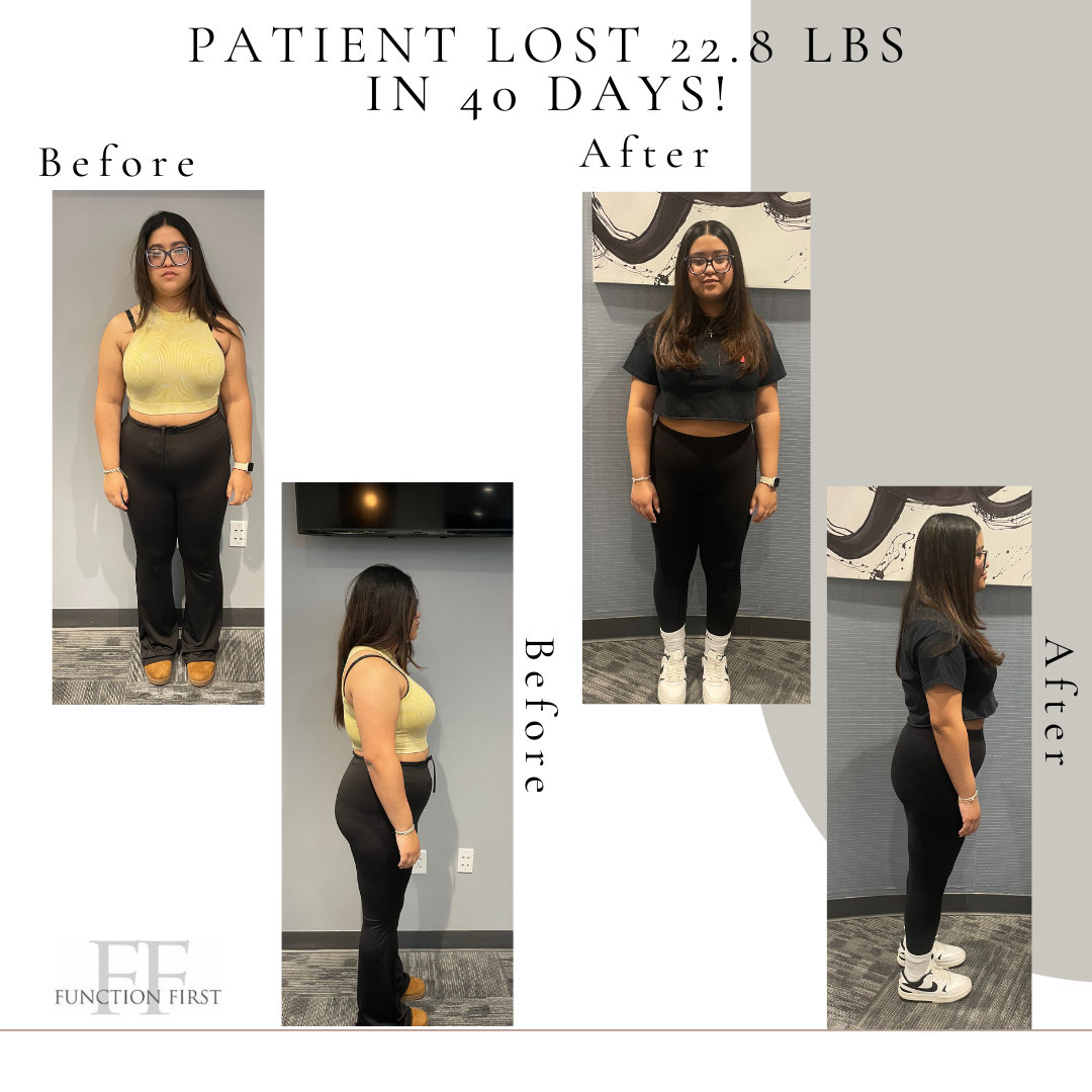 weight loss program in carmel before and after