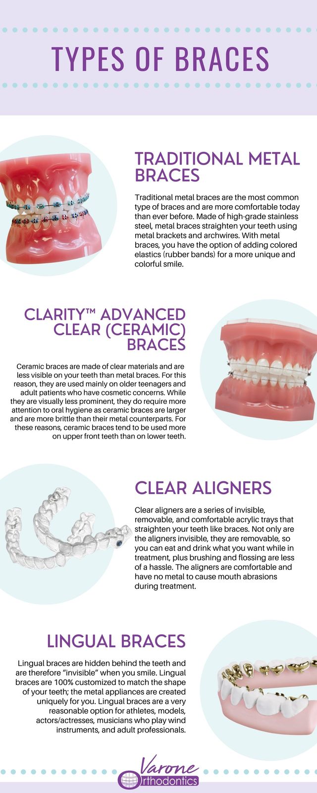 Orthodontic Treatment Process