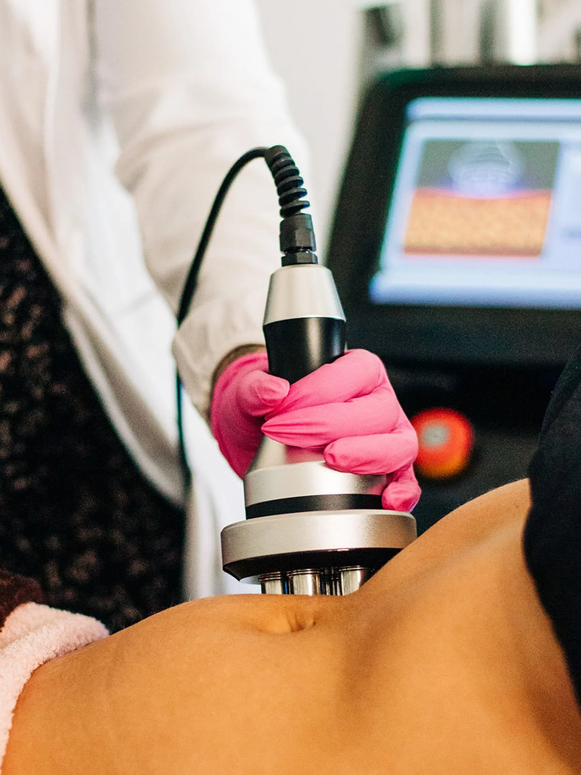Person's abdomen being treated with a radiofrequency device. Hands in pink gloves hold the device.