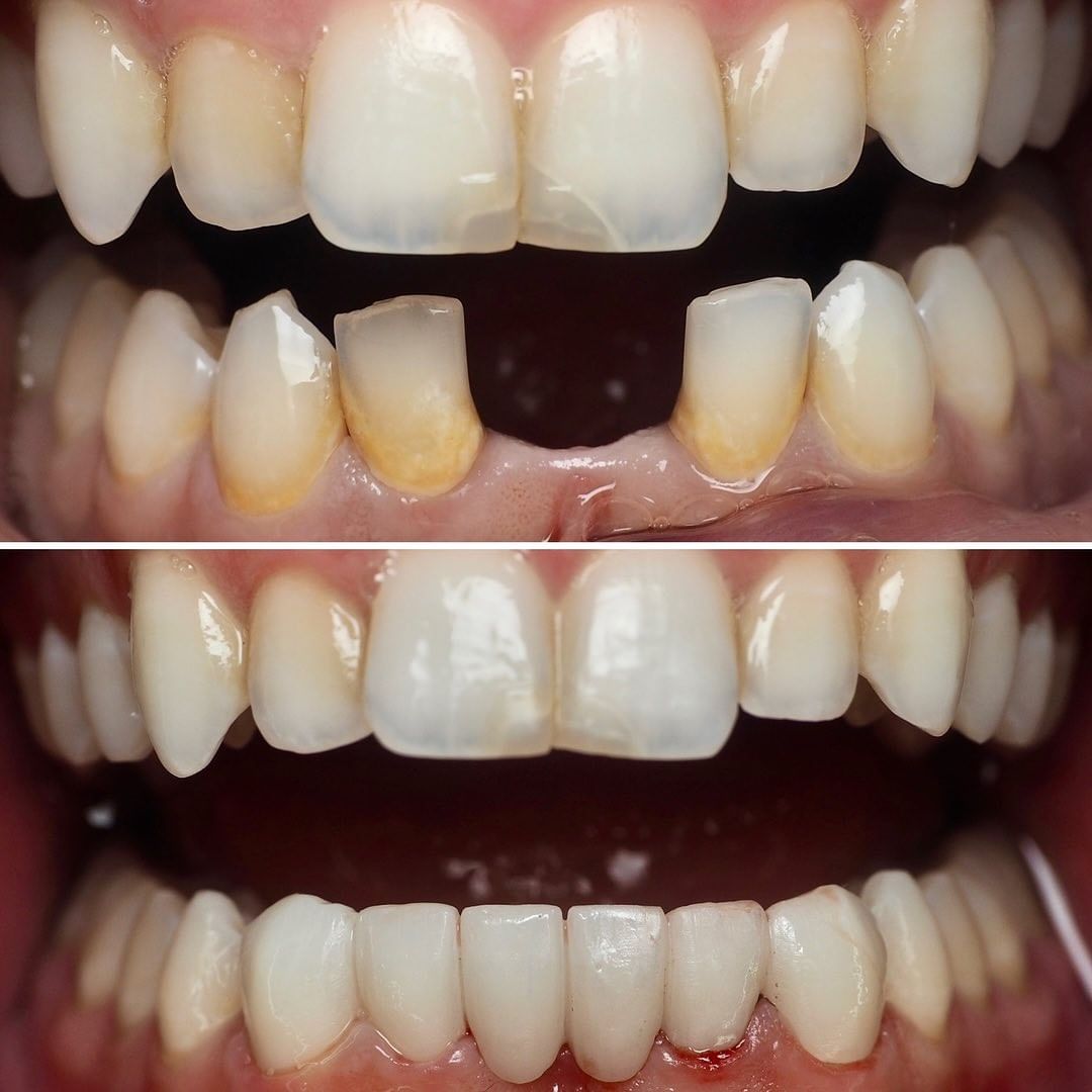 Cosmetics before and afters