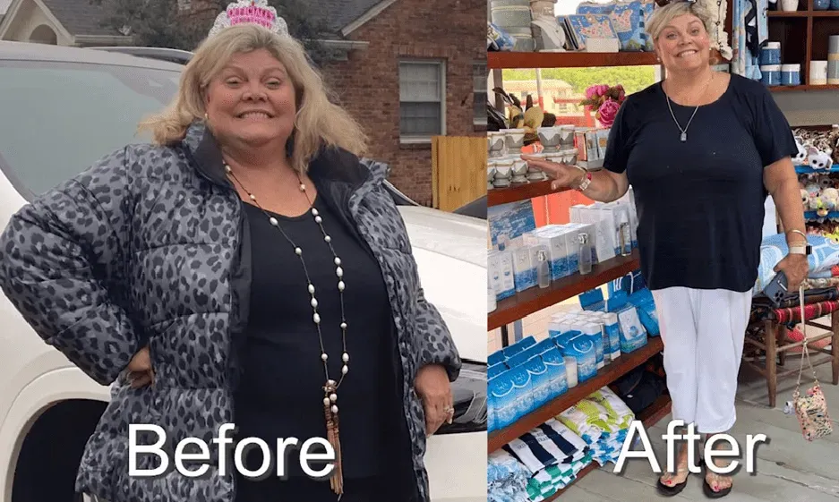 Side-by-side photos of a woman before and after weight loss. She is smiling. Before: Wearing a jacket outside. After: Inside a store.