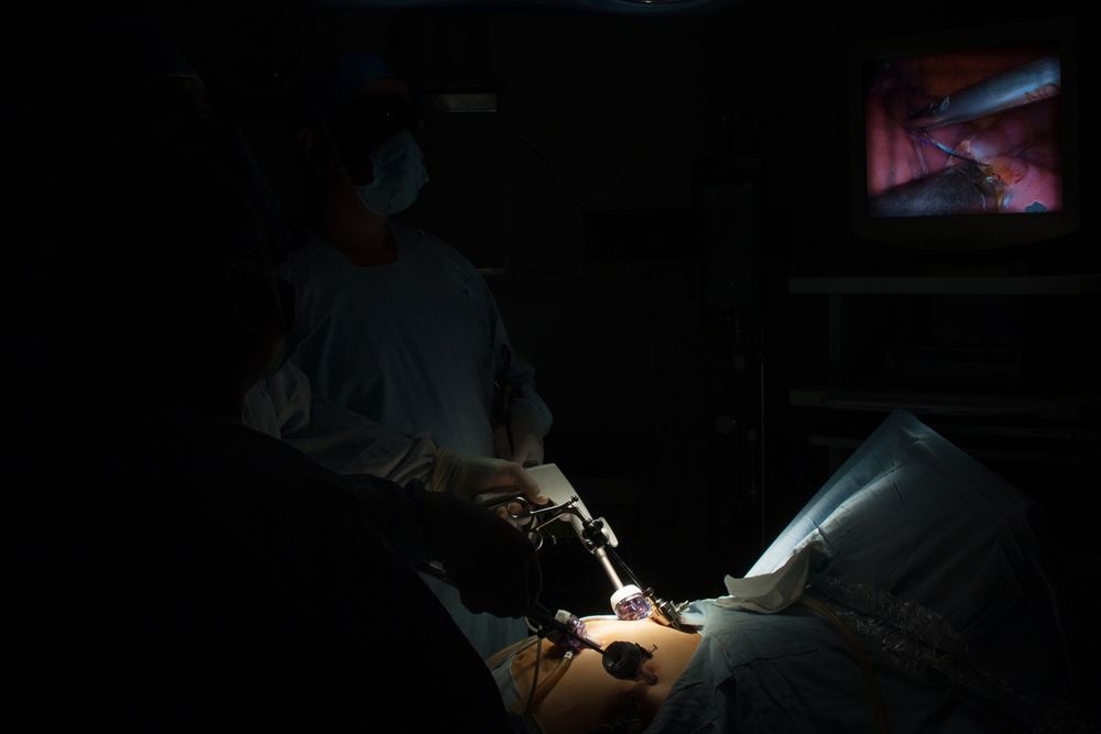 A Surgeon is Operating on a Patient in a Dark Room — Brisbane Upper GI Surgery in Chermside, QLD