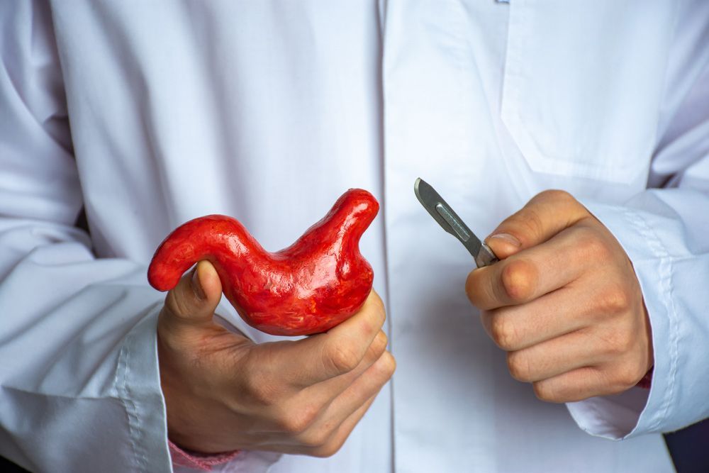 A Doctor is Cutting a Red Pepper With a Scalpel — Brisbane Upper GI Surgery in Chermside, QLD