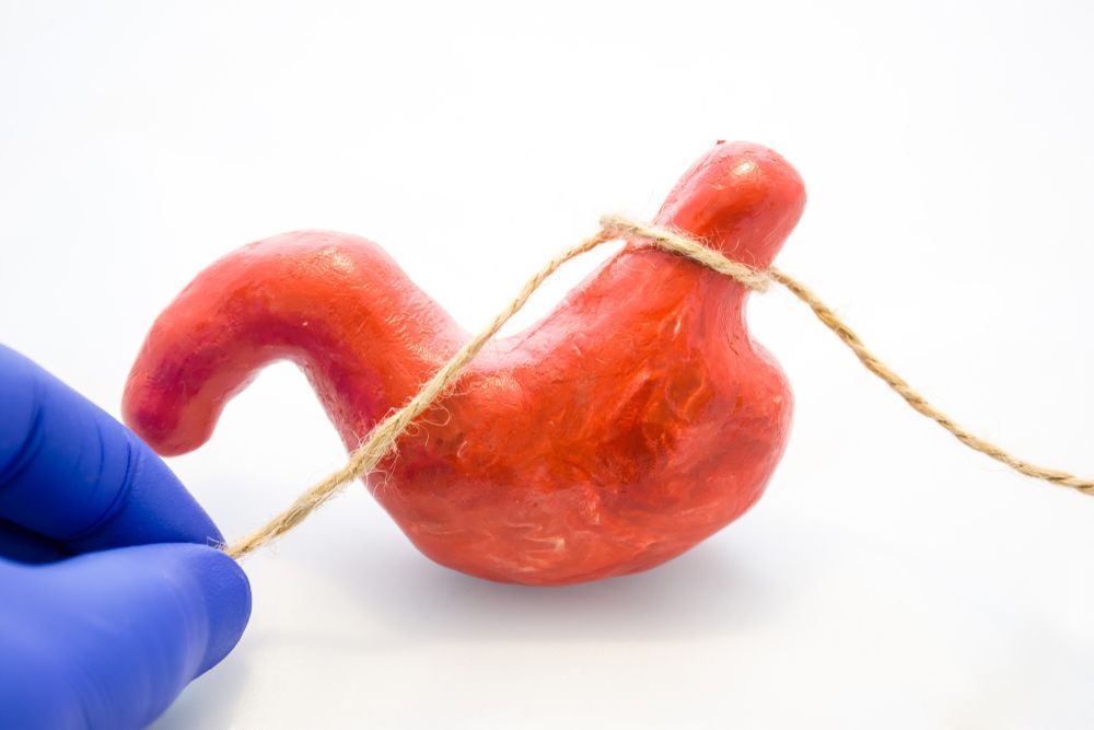 Gastric Surgery For Weight Loss 
